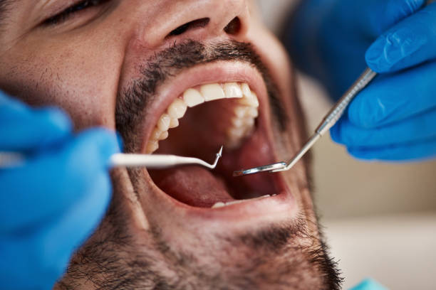 Best Emergency Denture Repair in Spring Valley Lake, CA